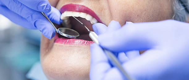 Best Emergency Treatment for Dental Infections or Abscesses in Clearwater, FL